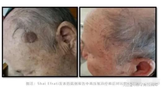 1400万跌至30万！西方“续命舱”惊现国产替代西方好日子到头了(图3)